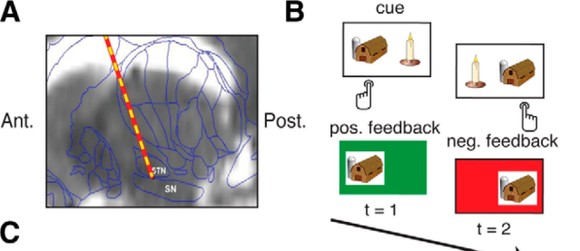 (A) Electrodes were implanted into a part of the brain called the substantia nigra. (B) Participants made choices between two cues, which were selected with the left or right button. They then saw whether their choice had been a good or bad one (positive or negative feedback). In reality, it was important which cue they picked, but not which side (left or right) it was on. However, when the investigators stimulated a part of the brain called the substantia nigra, they found that participants paid more attention to which side had been producing more rewards recently.